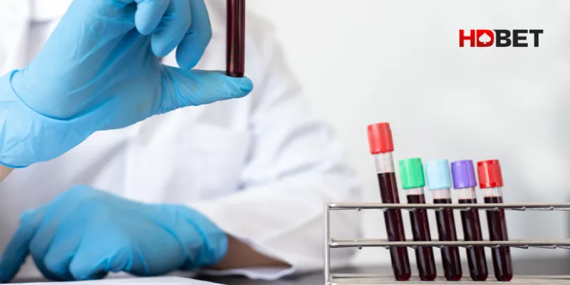 Tham khảo mẹo soi cầu nằm mơ thấy máu đánh con số gì